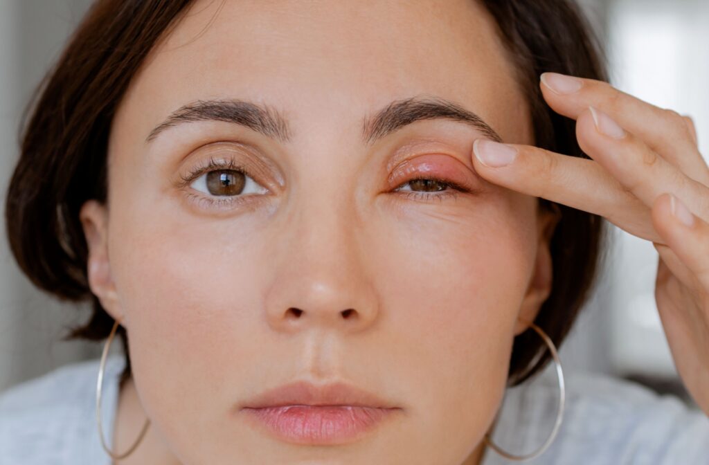A close-up of a woman checking her left eye which is possibly infected.