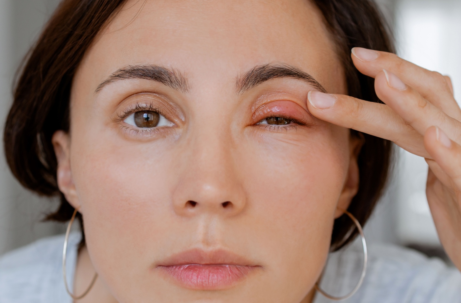Should You Go to Urgent Care for Eye Issues? | Santa Cruz