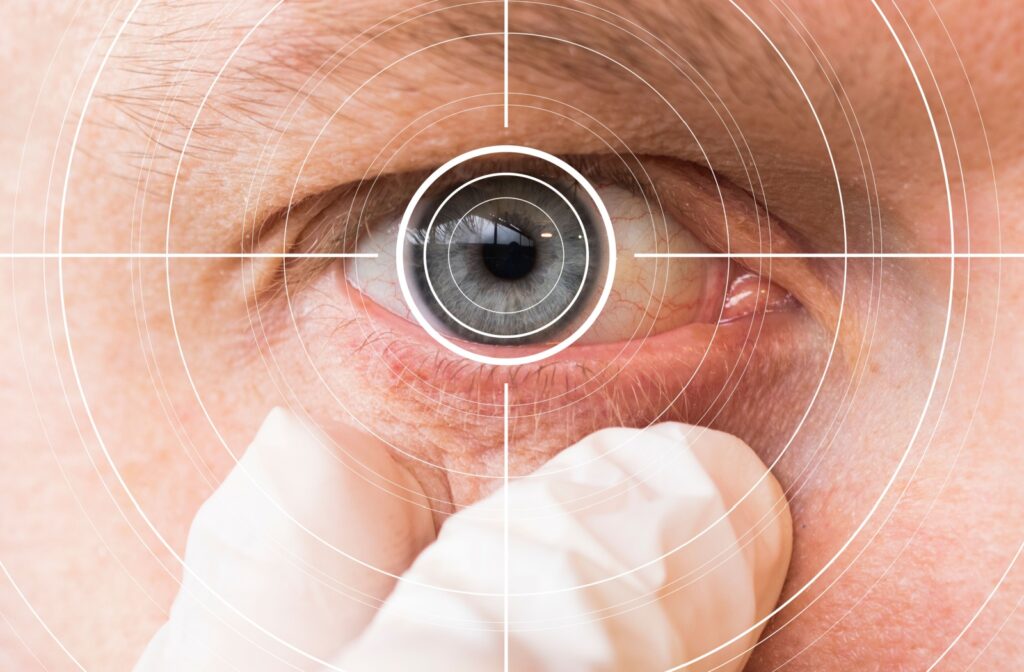 A person stares straight ahead while a gloved hand probes the skin under their eye. A white targeting reticle is centered on the iris.